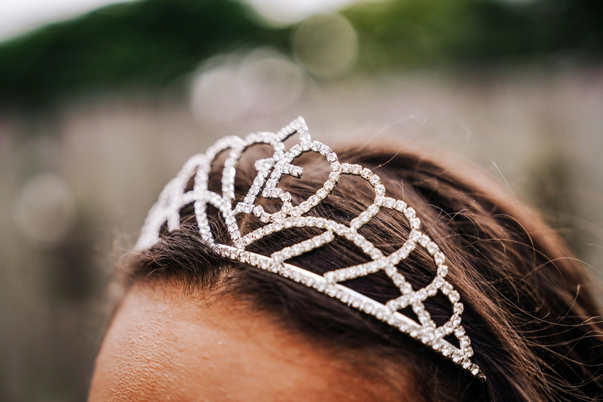 Exploring The Benefits Of Accessory Dwelling Units In Backyards